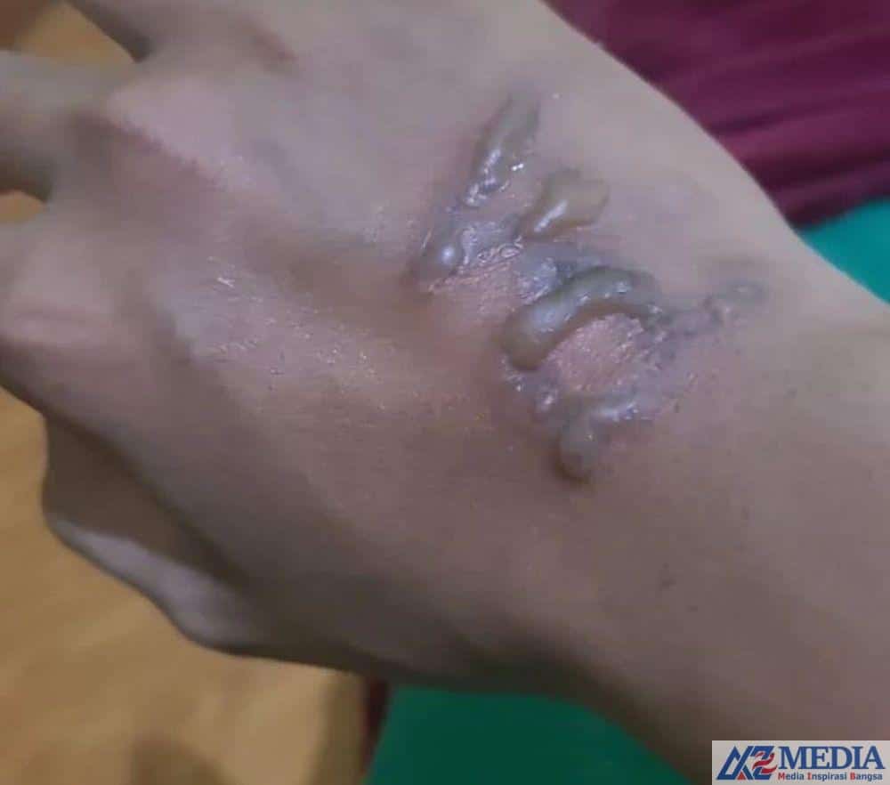 IMG 6250 Siswa di Medan Dipaksa Makan Lumpur,Hingga di Sundut Besi Panas